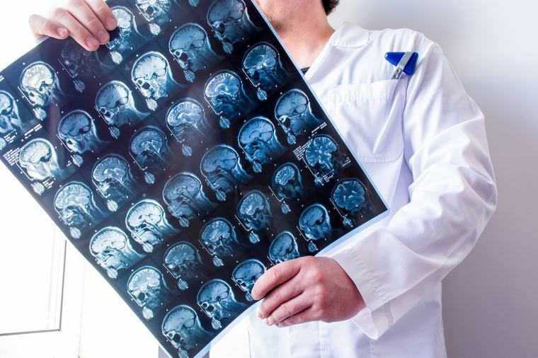 Neurologista: o que é, que doenças cuida (e quando consultar)