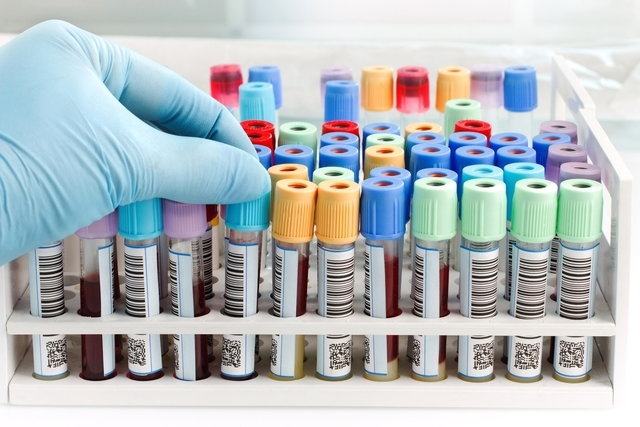 Check-up médico: quando fazer, tipos (e para que serve)